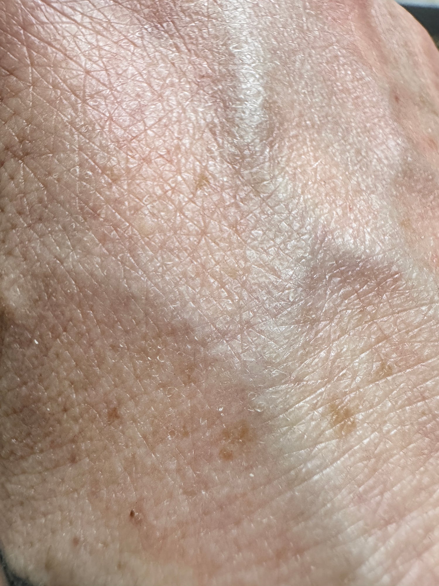 Pflege für Trockene Haut